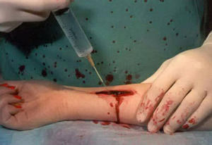 Post image for DIY Antiseptic Solution for Irrigating Wounds