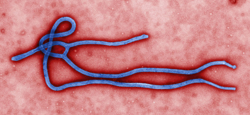 Ebola Virus 01